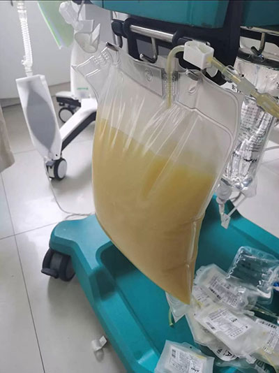 ¶ǣһиֱӽICU