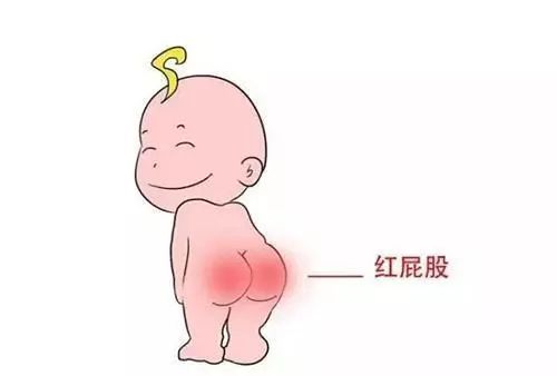 㣬Զ롰ƨɡ