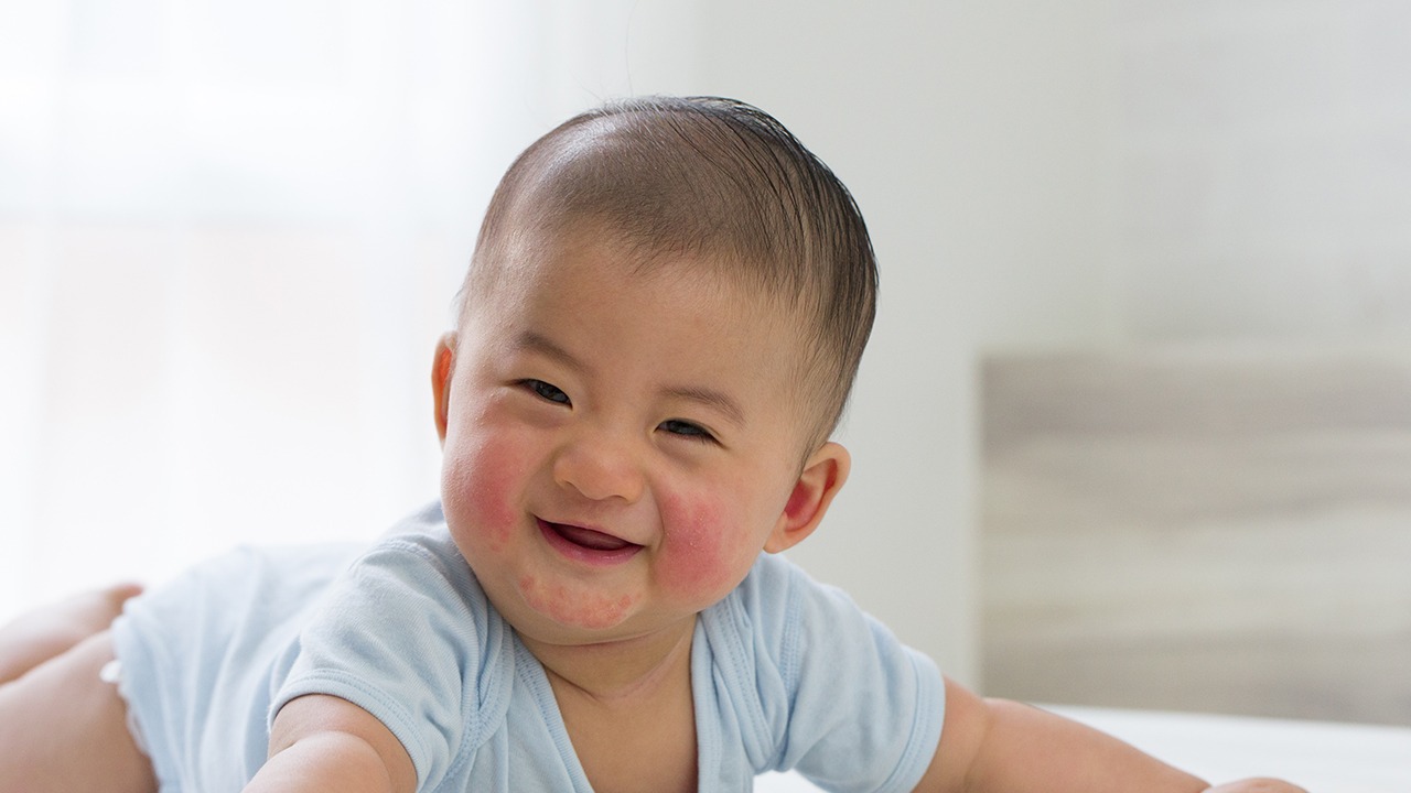 婴儿舌苔厚白的原因 ​婴儿舌苔厚白怎么调理？