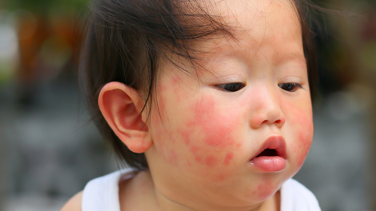 婴儿流感症状有哪些？婴儿流感会带来哪些并发症？