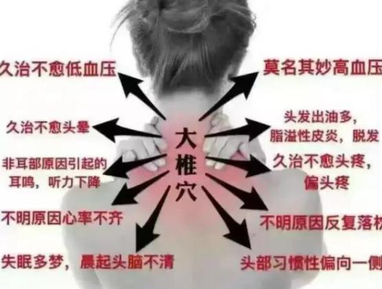 富贵包怎么消除最有效 运动、按摩、针灸、药贴