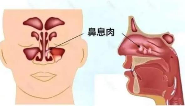 ҽƱϢ ϢҪЩ