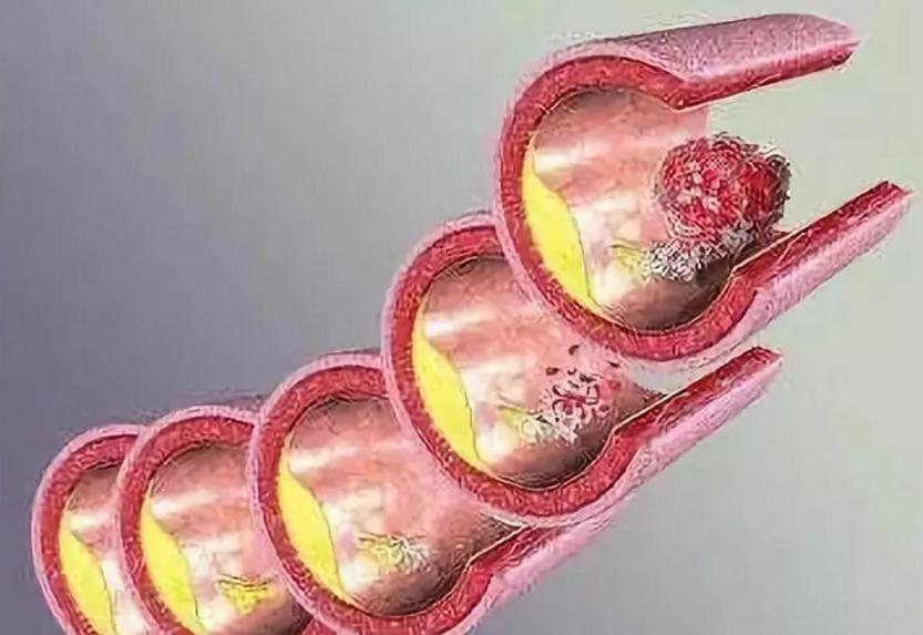 ̬ũҵΪءߡ