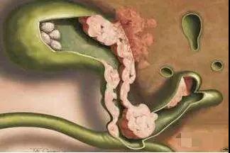 ΢ͼƬ_20200403143007.jpg