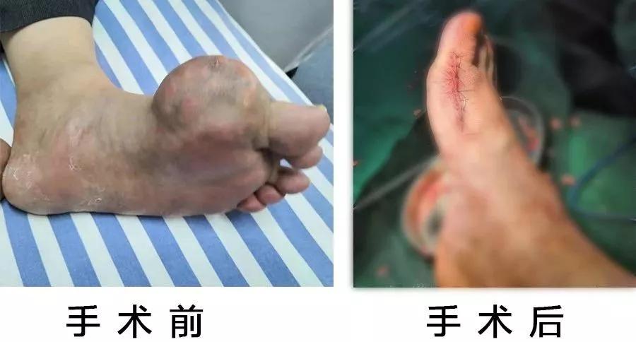 Ŀ!ӽֺؽȡ쵰󣢵ʹʯ!