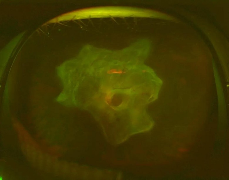 33ӻ18꣬Ĥ䣬Щʧ