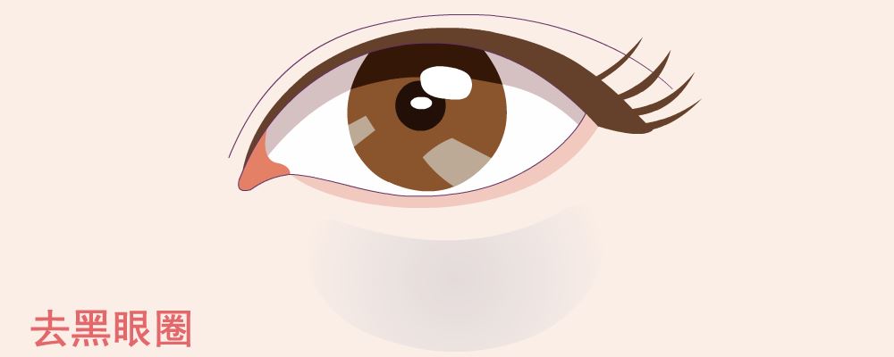 黑眼圈很重是什么原因 黑眼圈很重怎么办 黑眼圈很重如何消除