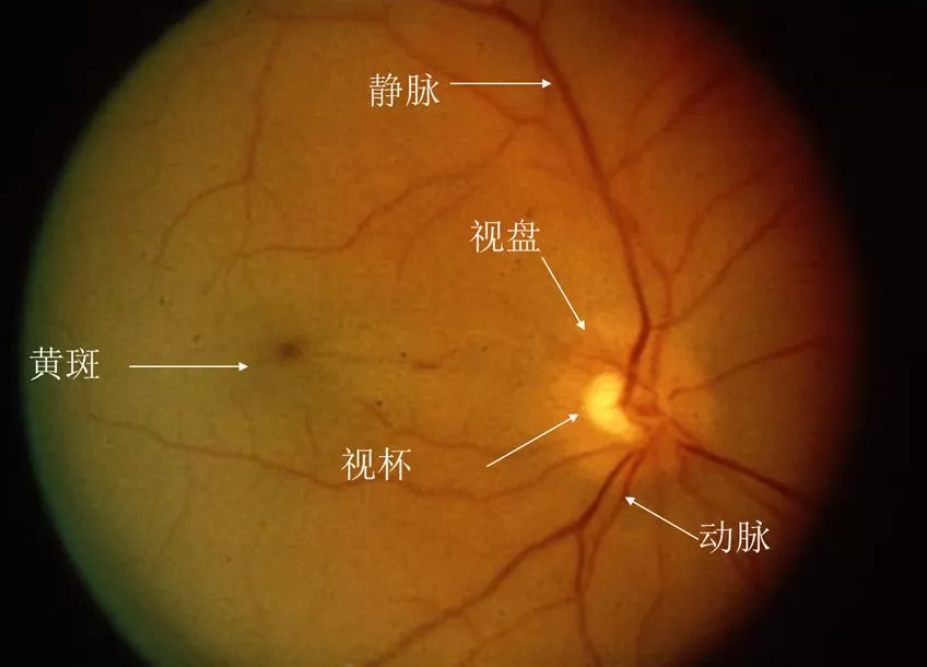 上海眼科院长：身体有其他疾病可以做白内障手术吗？手术安全吗？