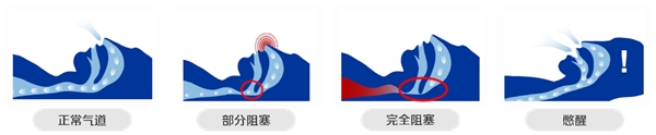公眾人物睡眠打鼾再上熱搜，好睡眠還有多遠？