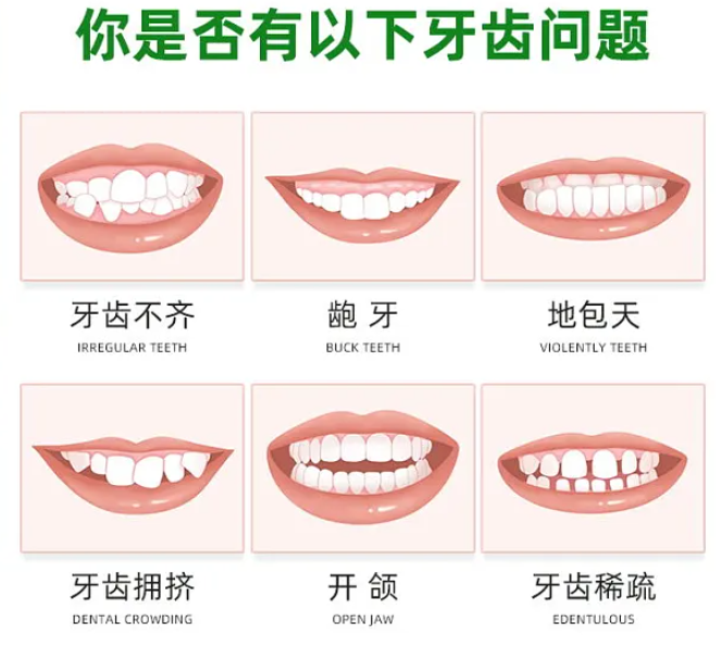 重庆北培牙齿矫正术要去哪里做？乐嘉口腔医院专业口腔健康