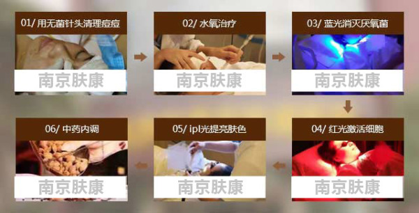 ϾƤоôר ߺ糱