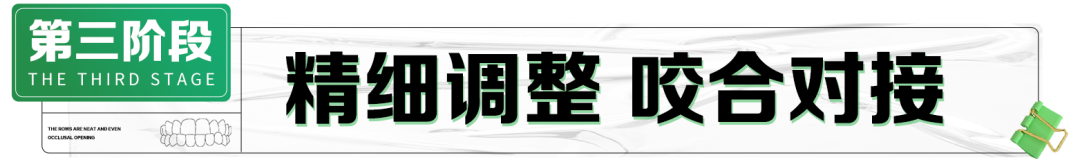 重庆北培牙齿矫正术要去哪里做？乐嘉口腔医院专业口腔健康