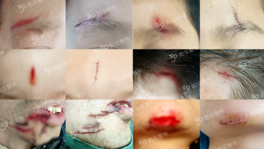 �ջ��ݣ�4�������Ϸ��룬��ĸ��һ����̫�ؼ���