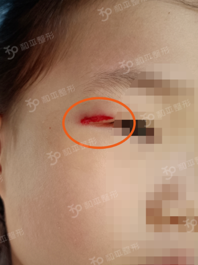 �ջ��ݣ�4�������Ϸ��룬��ĸ��һ����̫�ؼ���