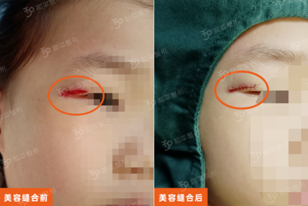 �ջ��ݣ�4�������Ϸ��룬��ĸ��һ����̫�ؼ���