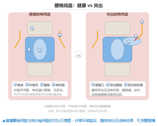 ���缹���գ��˳���ͻ֢�����������µ����Ϻ���������
