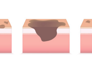 �Ȱ���ѡ����������Ѫ����̥��ҽԺ���￴�õ���������ܰ񹫿���